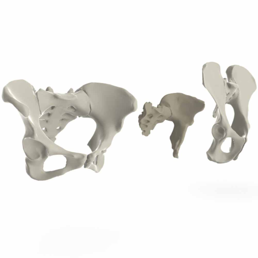 Pelvis of Australopithecus afarensis (Lucy) compared to a modern human and recent chimpanzee pelvis