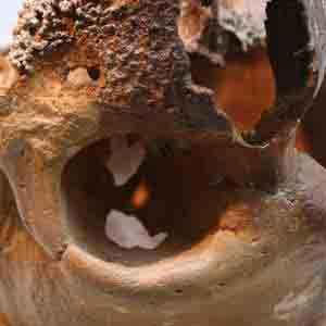 Closeup of Monte Circeo 1 skull