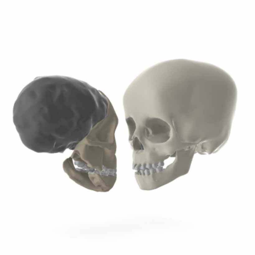 Taung cranium compared to modern human child